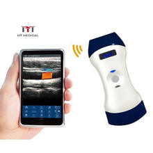 Hot Sales Mini Portable Wireless Linear Ultrasound Probe Pocket Handheld Ultrasound Scanner Probe